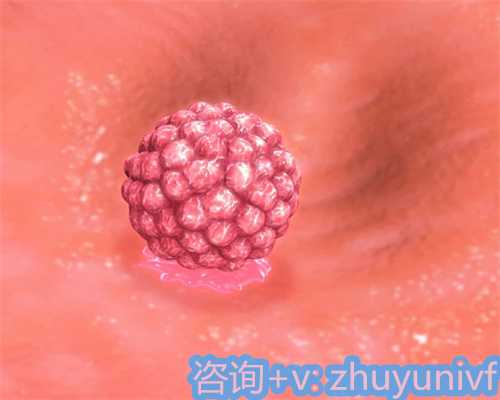 广州供卵试管成功率评估（台湾供卵成果）