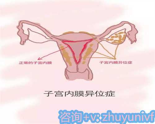 广州试管助孕机构选择指南与专业推荐